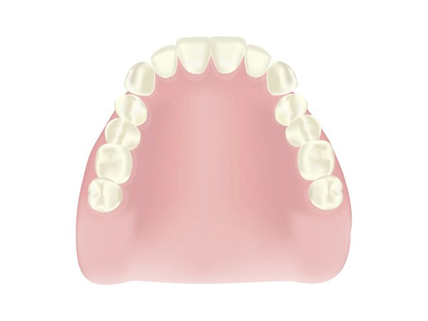 レジン床入れ歯（保険適用の総入れ歯）