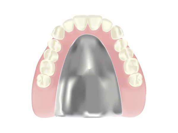 金属床入れ歯